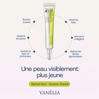 Retinal shot | Vanelia